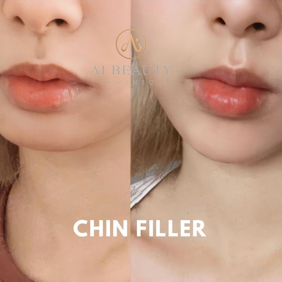 Ai Beauty  — photo 2