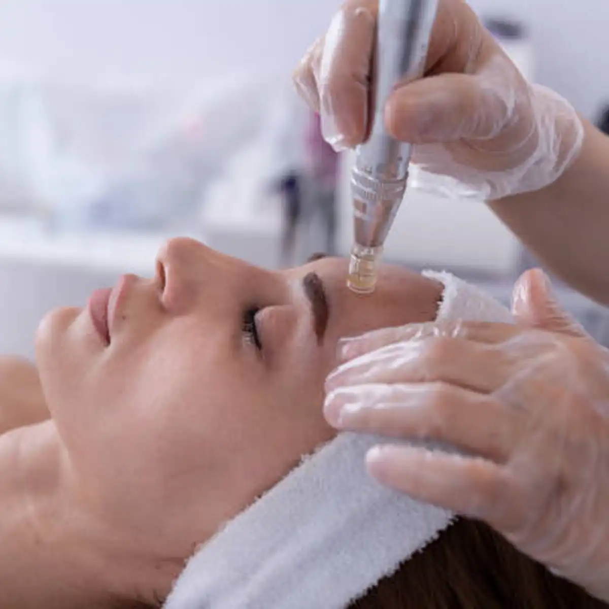 PCOS & Skin: The Fashion-Week-Ready Guide for Breakouts, Texture & Pigmentation